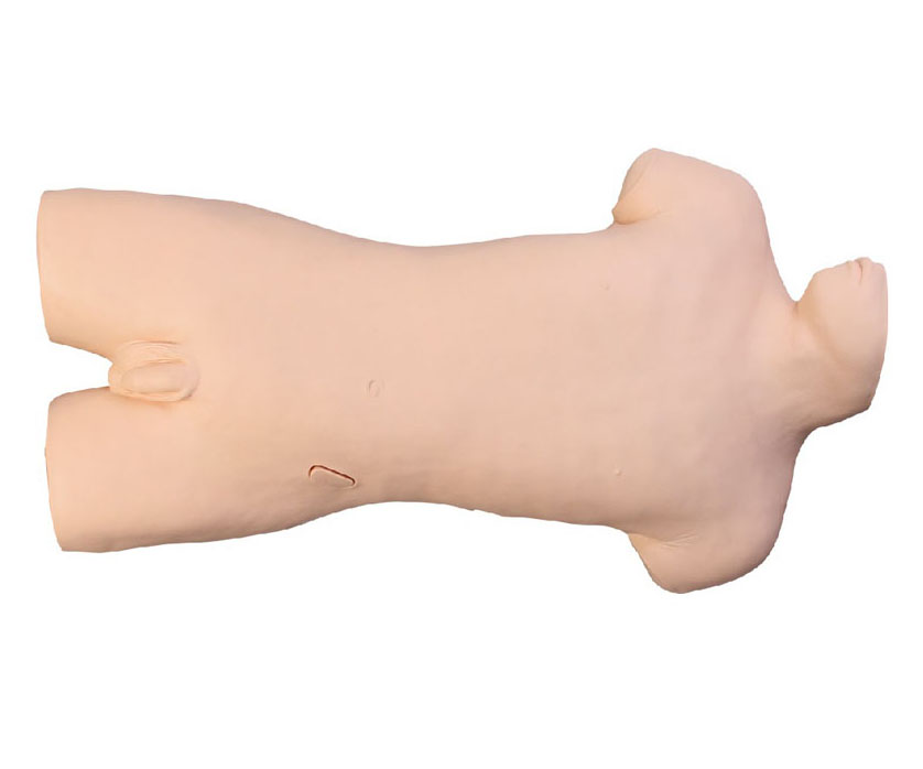 腹腔穿刺训练模型